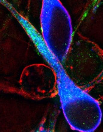 Super-resolution fluorescence micrograph of a GnRH neuron in blue with actin in red and microtubule tip protein in green