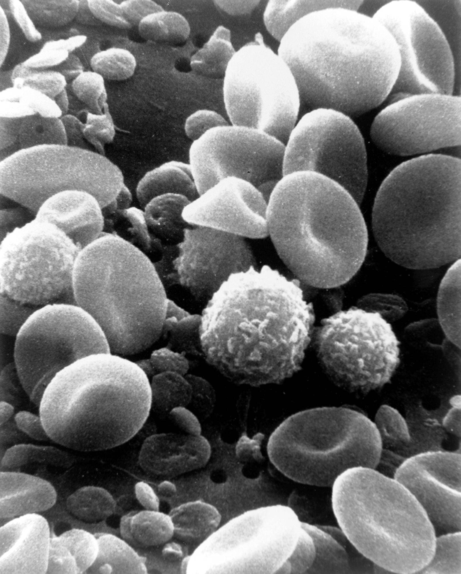 Black and white scanning electron micrograph of red blood cells, small platelets and textured white blood cells