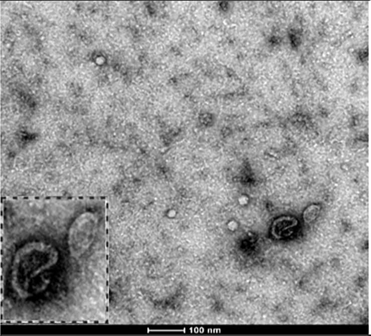 Grayscale transmission electron micrograph of small extracellular vesicles from stromal cell culture media, with an inset showing a cup-shaped vesicle and 100 nm scale bar