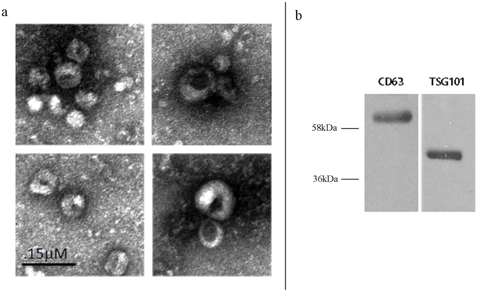 Four electron micrograph panels of round cup-shaped vesicles beside a Western blot with a CD63 band above the 58 kDa marker and a TSG101 band between the 36 and 58 kDa markers