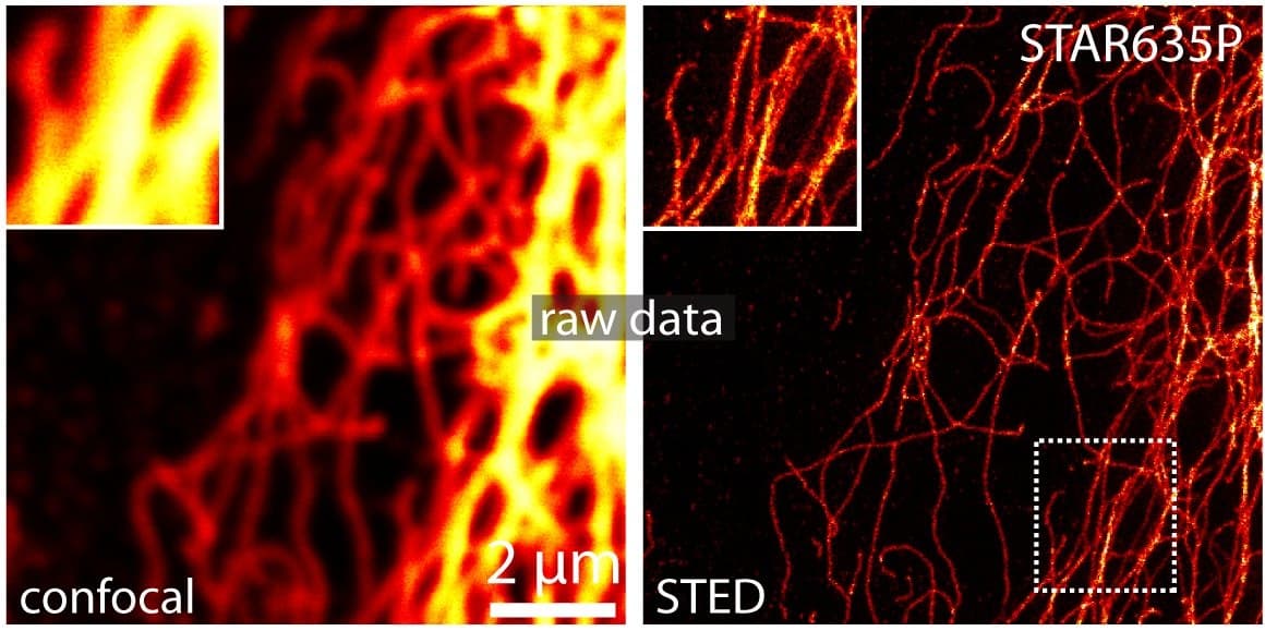 Side-by-side fluorescence images of the same filaments, blurred in the confocal image on the left and sharply resolved in the STED image on the right