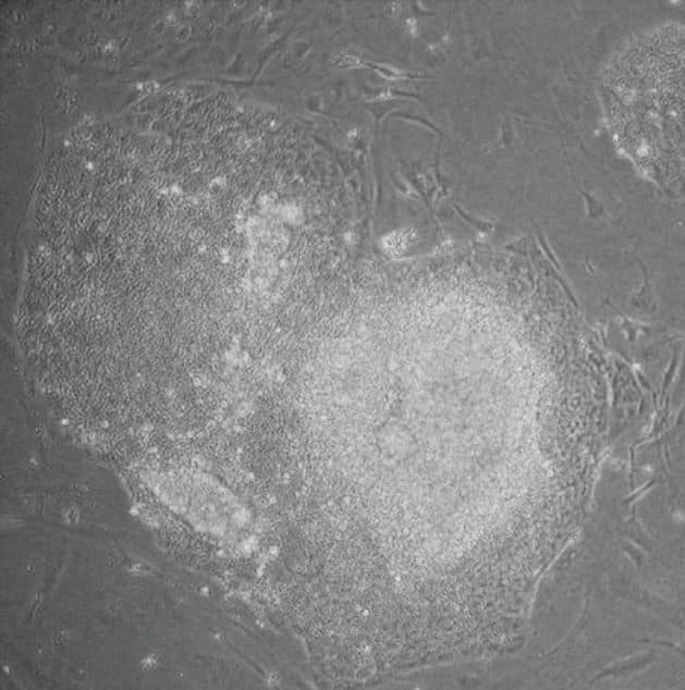 Phase contrast micrograph of a large, compact human iPSC colony with a defined border, surrounded by spindle-shaped mouse feeder fibroblasts