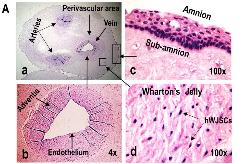 Hematoxylin and eosin sections of a human umbilical cord: a low-power cross-section with two arteries, the vein and the perivascular area, a vein wall, the amnion and subamnion, and Wharton’s jelly with scattered stromal cells
