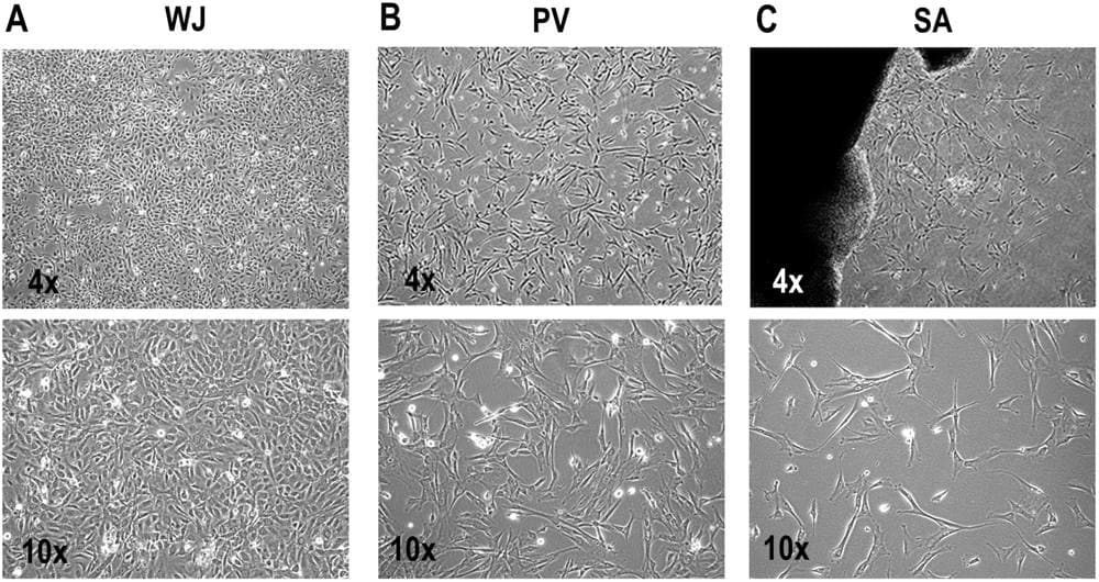 Phase contrast micrographs at 4x and 10x of MSCs in primary culture from Wharton’s jelly, the perivascular region and the subamnion of the umbilical cord