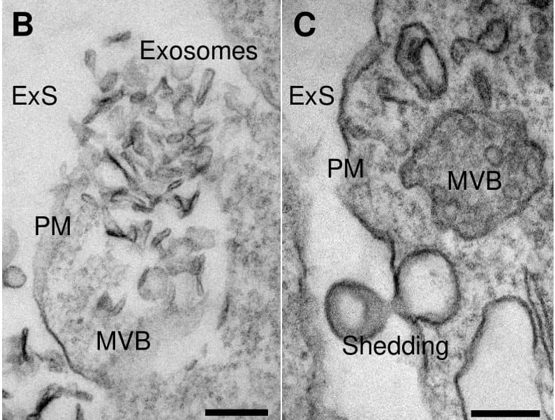 Two transmission electron micrographs from a chick embryo trigeminal ganglion: left, a multivesicular body opening at the plasma membrane with small vesicles in the extracellular space; right, a round vesicle budding from the plasma membrane next to a multivesicular body
