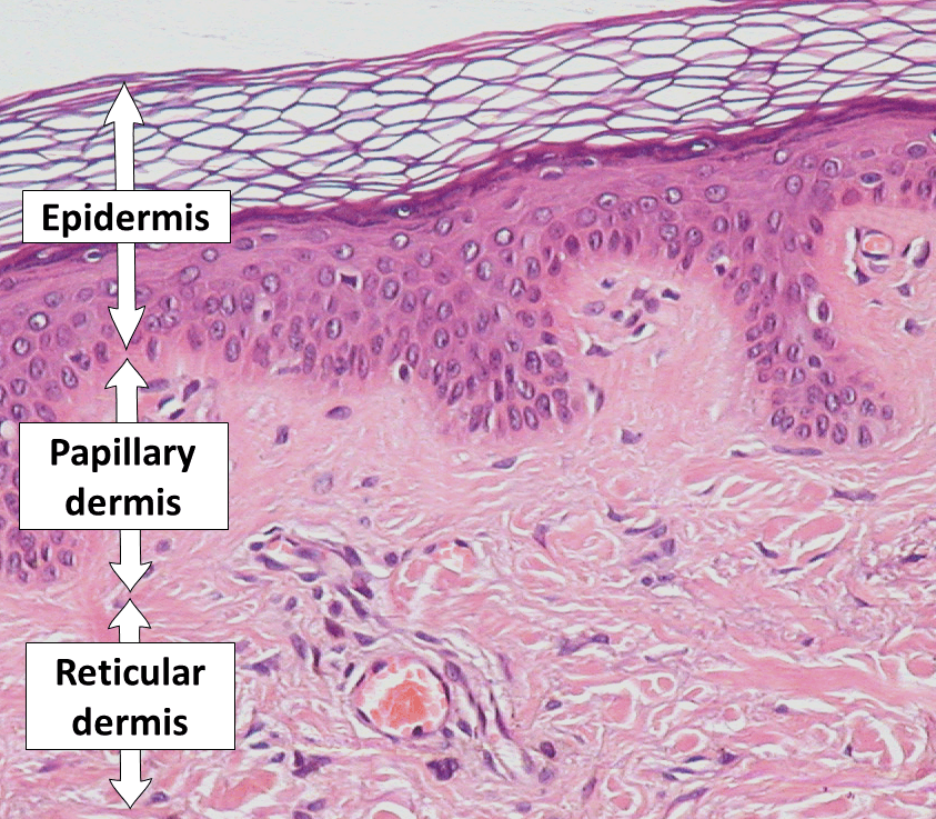 Hematoxylin and eosin stained skin section labeled epidermis, papillary dermis and reticular dermis