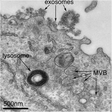 Transmission electron micrograph of a cell releasing exosomes at the plasma membrane next to a multivesicular body and a lysosome