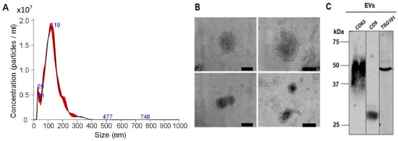 Three-panel published figure: a nanoparticle tracking size distribution peaking near 119 nm, four electron micrographs of vesicles, and a western blot with bands for CD63, CD9 and TSG101.