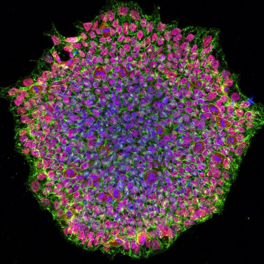 Fluorescence micrograph of a round colony of human induced pluripotent stem cells with nuclei in blue and pink and green cell borders