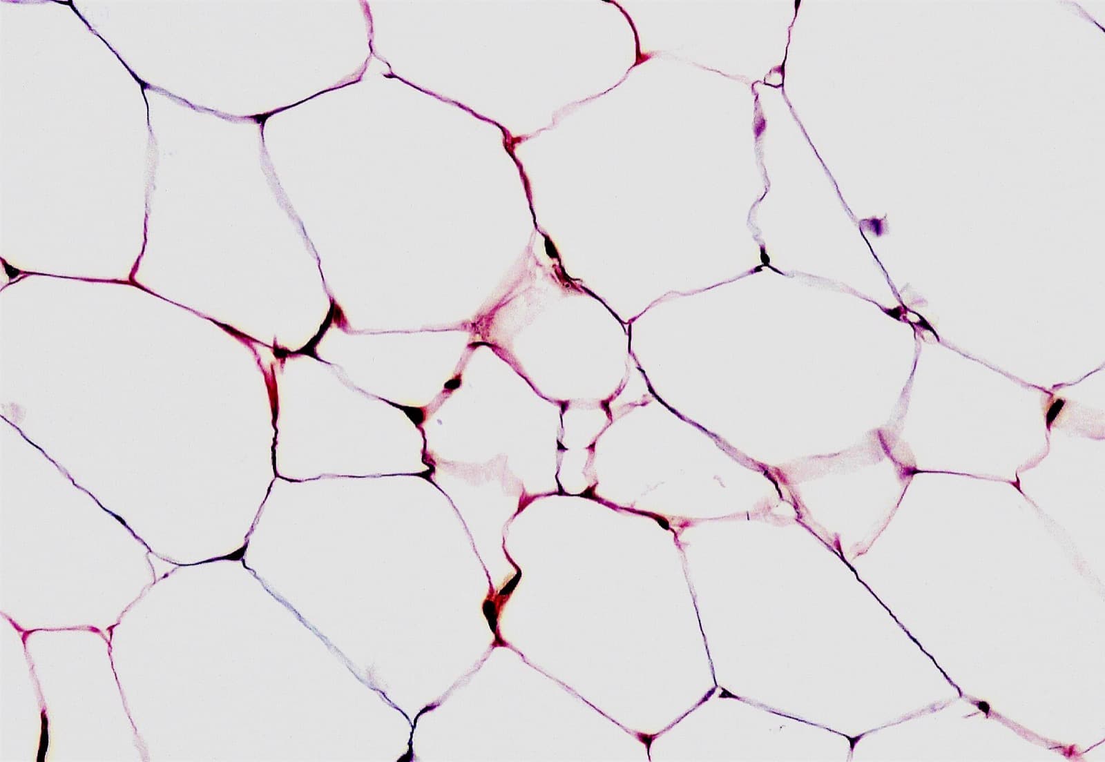 Stained light micrograph of normal adipose tissue showing large empty-looking fat cells separated by thin pink and purple membranes