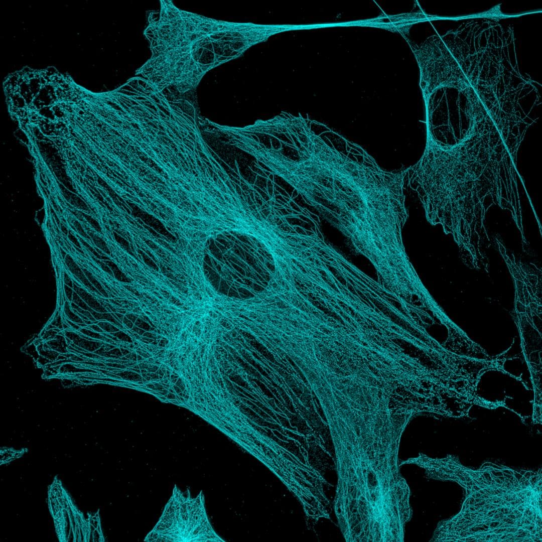 Confocal fluorescence micrograph of cultured fibroblasts with their microtubule network stained cyan on a black background
