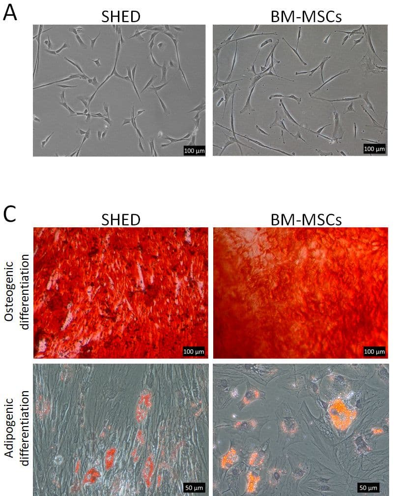 Phase contrast micrographs of spindle-shaped stromal cells from dental pulp and bone marrow, above Alizarin red stained osteogenic cultures in deep red and Oil Red O stained adipogenic cultures with red lipid droplets