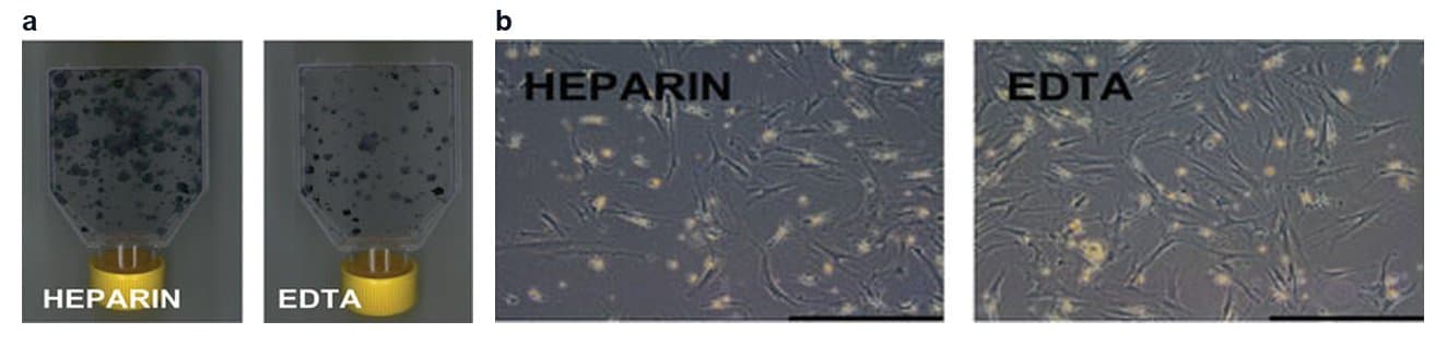 Two panels: culture flasks with many dark stained fibroblast colonies grown from human bone marrow, and a phase contrast view of spindle-shaped human bone marrow stromal cells in culture
