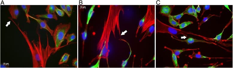 Three immunofluorescence micrographs of mesenchymal stromal cells co-cultured with bronchial epithelial cells: F-actin in red, epithelial cytokeratin in green and nuclei in blue, with white arrows marking thin F-actin tubes that connect stromal and epithelial cells