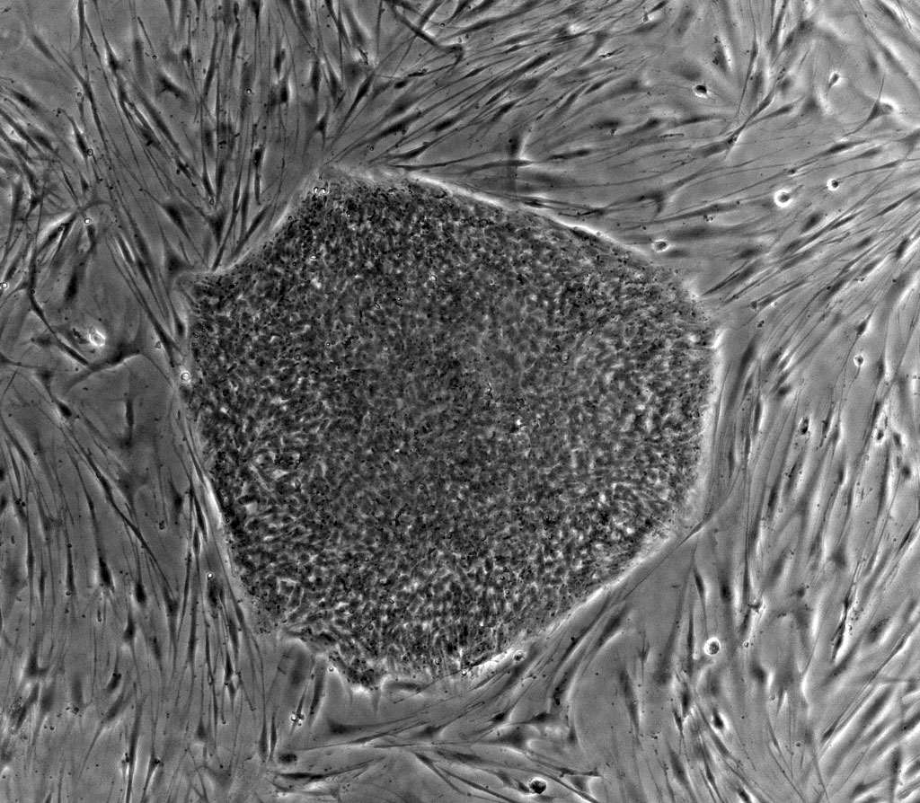 Phase contrast micrograph of a compact, rounded colony of small, tightly packed human embryonic stem cells surrounded by elongated, spindle-shaped mouse embryonic fibroblasts