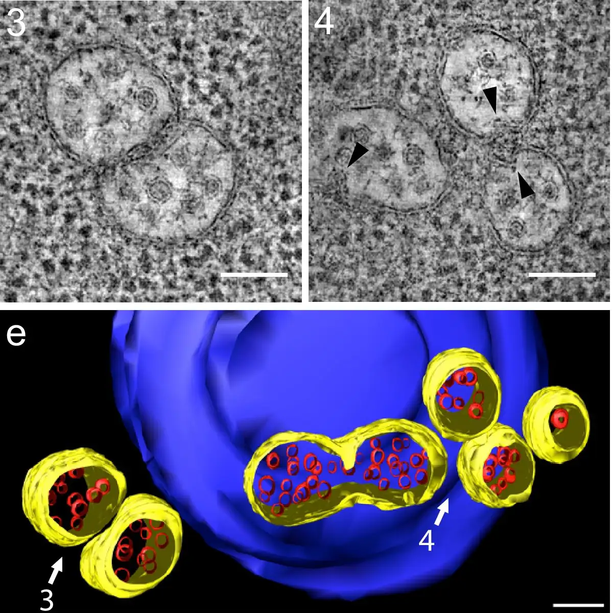Electron tomogram slices of yeast multivesicular bodies, round organelles holding small intraluminal vesicles with arrowheads on buds at the limiting membrane, above a 3D model with yellow limiting membranes, red vesicles and a blue vacuole