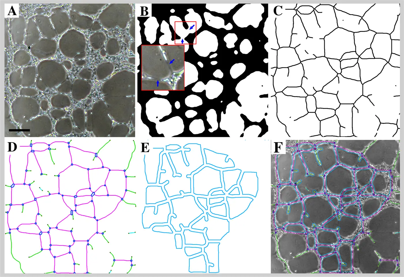 Six panels of an endothelial tube formation assay: a phase contrast image of a HUVEC network, its binary segmentation, its skeleton, colored detection of branches, segments and junctions, a map of closed meshes, and the detected objects overlaid on the original image
