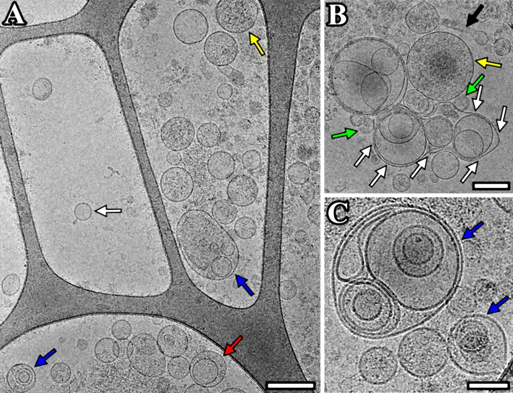Three cryo-electron micrographs of extracellular vesicles from human cerebrospinal fluid on a holey carbon grid, showing round vesicles with a visible membrane, double-membrane vesicles, vesicles with dense contents, sack-shaped and elongated vesicles, and nested multilayer vesicles, marked with colored arrows.